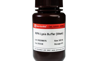 RIPA Lysis Buffer (weak)